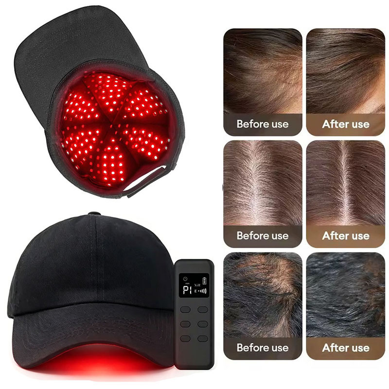 Gorro de Terapia de Luz Roja L - Hair Care Wella reseña y precio